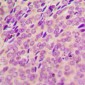 Anti-SYK (pY348) Antibody